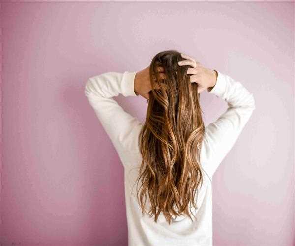 What is Dandruff?