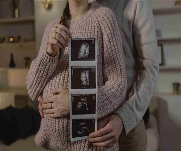 Risks of using Ultrasound in Pregnancy