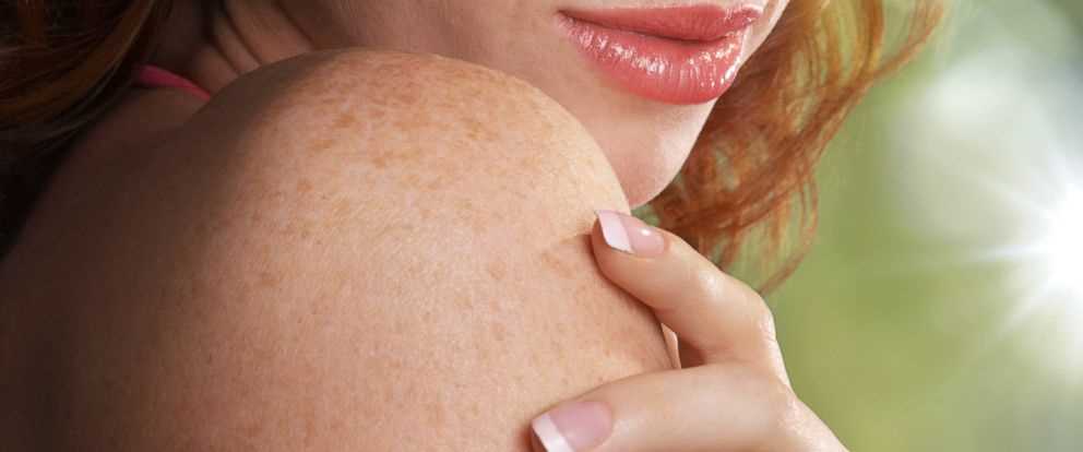 Different Types of Skin Problems: How To Cure it?