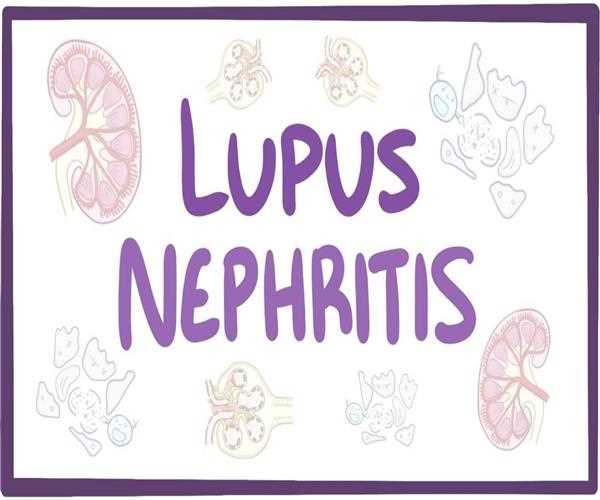 Lupus Nephritis: Symptoms, Diagnosis, and Treatment