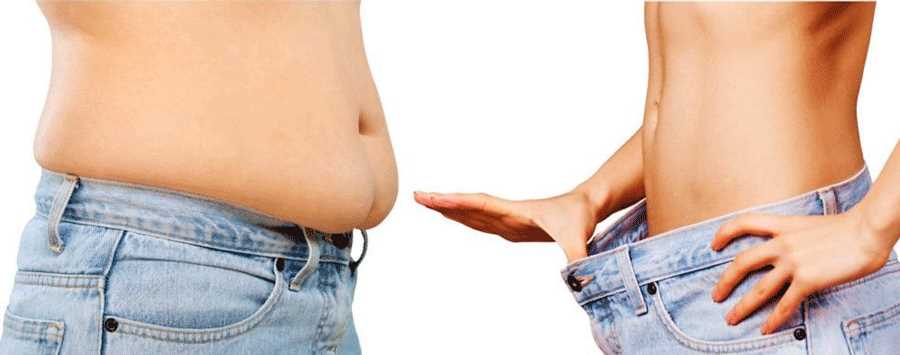 Weight Removed By Laser Liposuction In Dubai