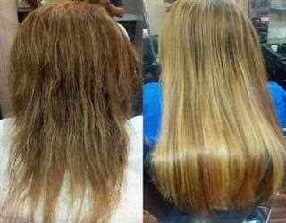 GET NEW HAIR AFRESH ON BALD HEAD WITHOUT SURGERY HERE!