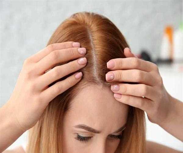 PRP Treatments For Much Hair Regrowth