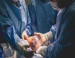 En-caul Birth- Is it a Myth or a Reality