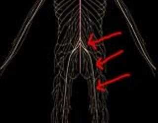 Chiropractic Care is The Best Pain Relief Option For Sciatica