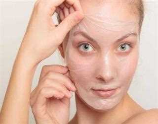 Melasma Treatment with Chemical Peels