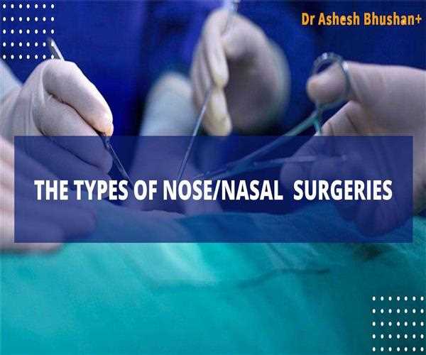 What are the types of nose/nasal  surgeries? Dr. Ashesh Bhushan