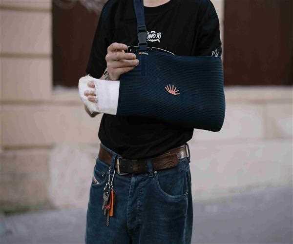 Broken Hand: Sympoms, Causes and Complications