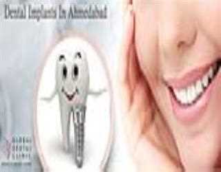 Get back your teeth- dental implant treatment on time