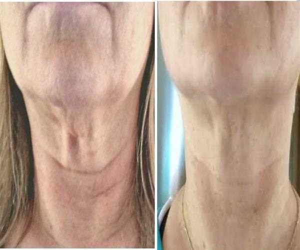 Best Tips To Get Rid Of Crepey Skin