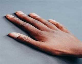 Treating  a  Broken Hand