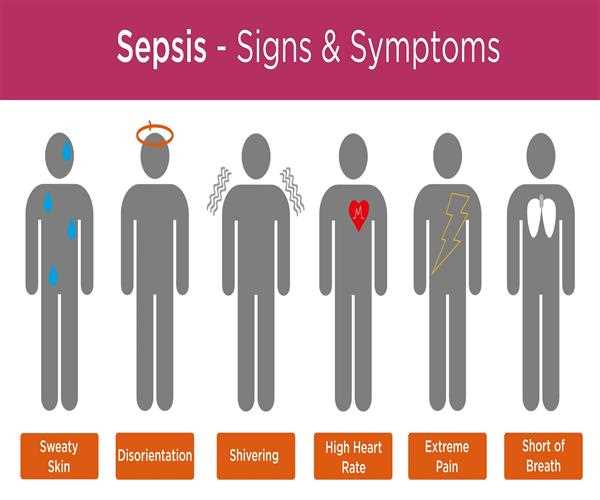 What is Sepsis? | EssayCorp
