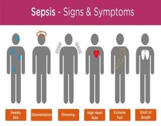 What is Sepsis? | EssayCorp image