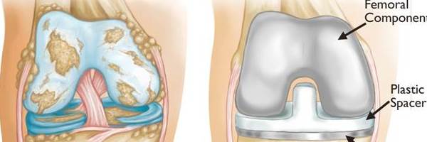 banner image of Joint & Bone Solutions 