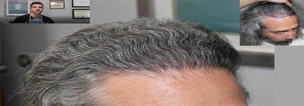 banner image of aleena rose