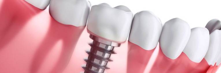 banner image of chandu John