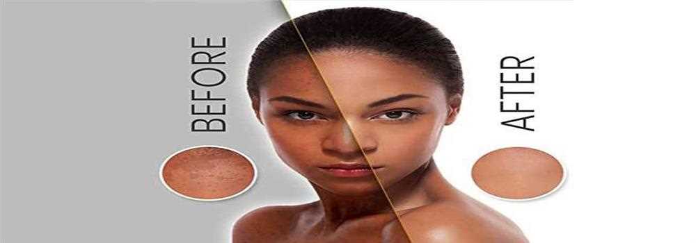 banner image of Pamela Foester