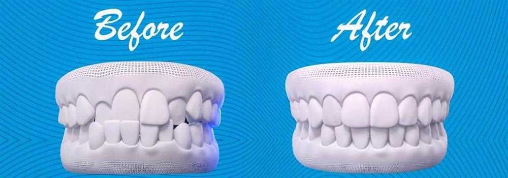 banner image of Invis India 