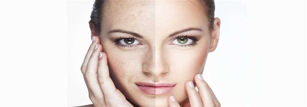 banner image of EpicDermis 