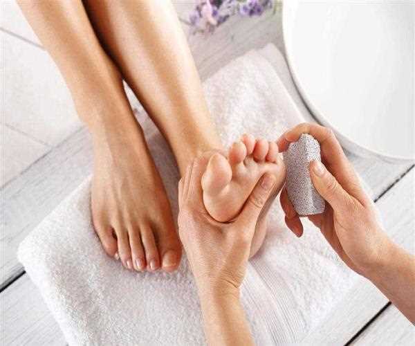 Understand the Callus and Its Treatment Procedures MindStick