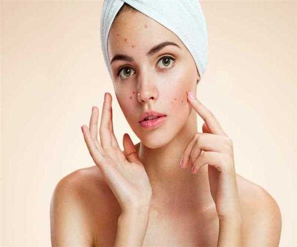 Treatment Options to Remove Wound Scars from Face