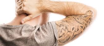 tattoo laser removal melbourne