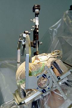 Neuro Surgery: Know About All Its Treatment Guidelines