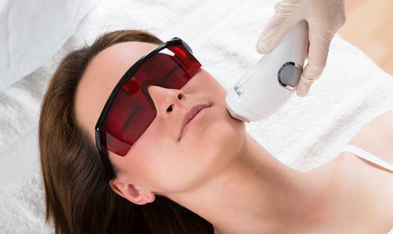 Laser Hair Removal Tips
