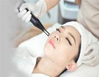 Say Goodbye to Pigmentation with Laser Toning