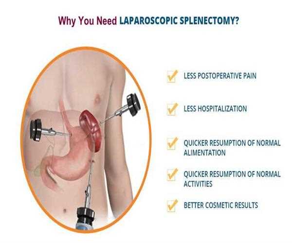 Are There Complications Faced Post-Laparoscopic Splenectomy Surgery?