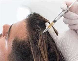 Advanced Hair Loss Treatment: Platelet Rich Plasma