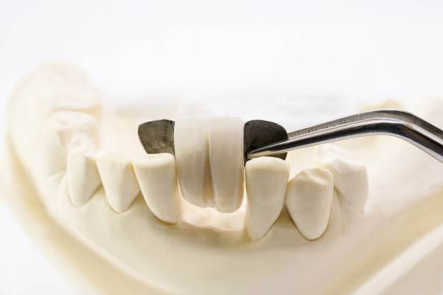 Total Mouth Reconstruction?