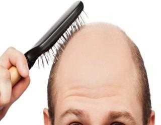 10 myths to debunk about hair transplants