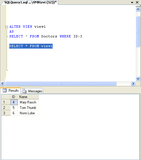 View in SQL Server