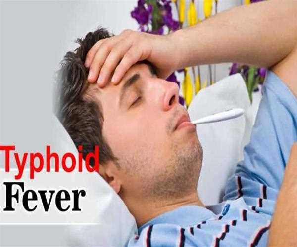 Typhoid fever- Causes, Symptoms, and Treatment
