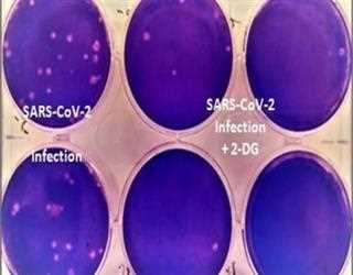 All New DRDO's anti Covid-19 drug 2-DG!