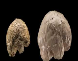 How Has the Human Brain Evolved?