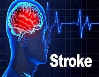 How to prevent strokes from happening?