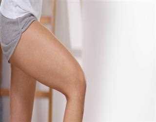 Dermapen Treatment for Old Stretch Marks