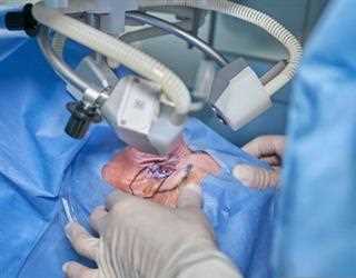 What is Laser Therapy?
