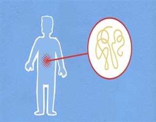 5 Signs of Cardinal Inflammation