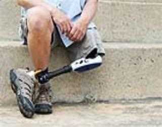 Few Information About Limb loss compensation