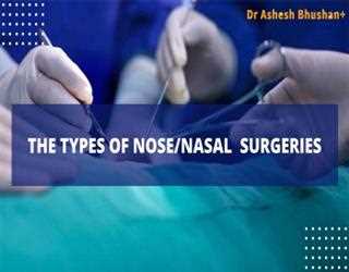 What are the types of nose/nasal  surgeries? Dr. Ashesh Bhushan