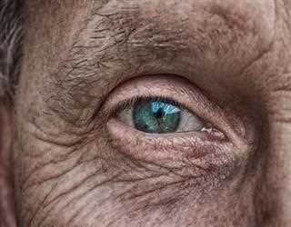 Types of Eczema