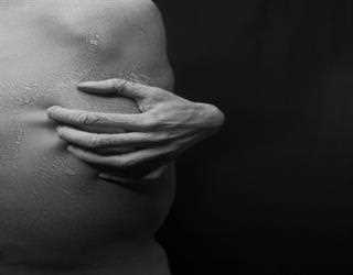 Symptoms and Causes of SCAD due to High Blood Pressure