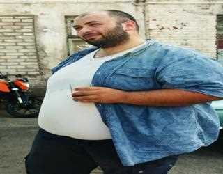 Childhood Obesity