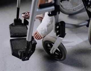 Broken Leg: Symptoms and Causes