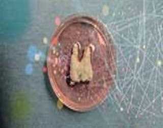 3D Printing for Building Organs