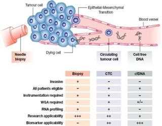 Liquid Biopsy