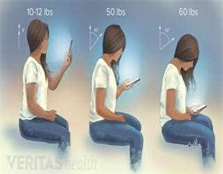 What Is Tech Neck?